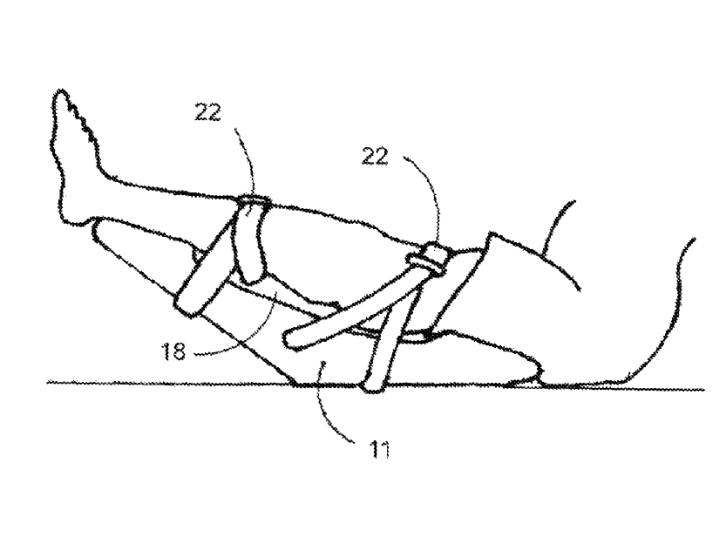 8,142,338 - Johnson; Lanny L. - Methods and devices for treating pathological conditions of the human knee