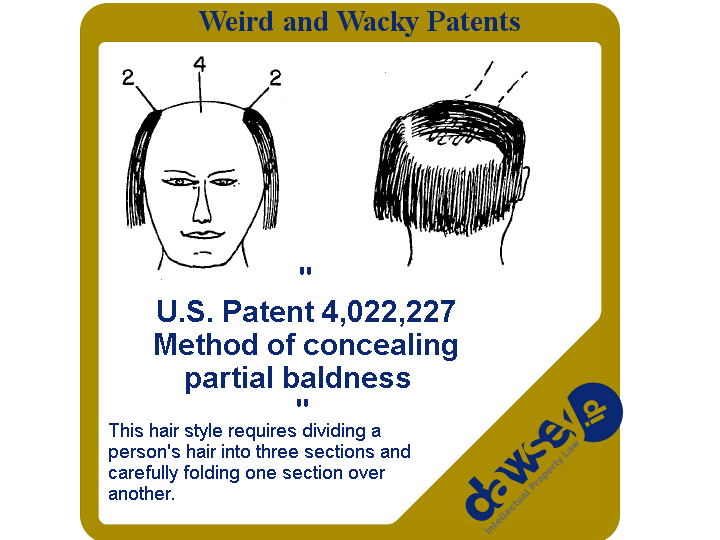 4,022,227 - Frank J. Smith; Donald J. Smith - Method of concealing partial baldness